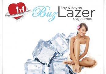 Buz Lazer